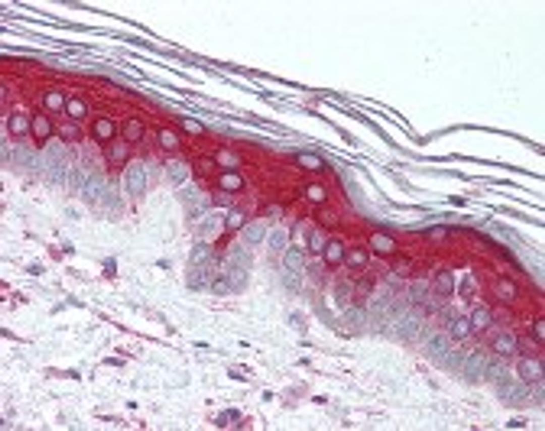 Immunohistochemistry staining of IRAK2 in skin tissue using IRAK2 Antibody.