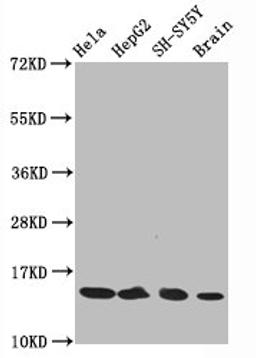 Western Blot. Positive WB detected in Hela whole cell lysate锛孒epG2 whole cell lysate锛孲H-SY5Y whole cell lysate锛孯at brain tissue. All lanes Acetyl-Histone H3.1(K14)antibody at 0.75μg/ml. Secondary. Goat polyclonal to rabbit IgG at 1/50000 dilution. Predicted band size: 15 KDa. Observed band size: 15 KDa.