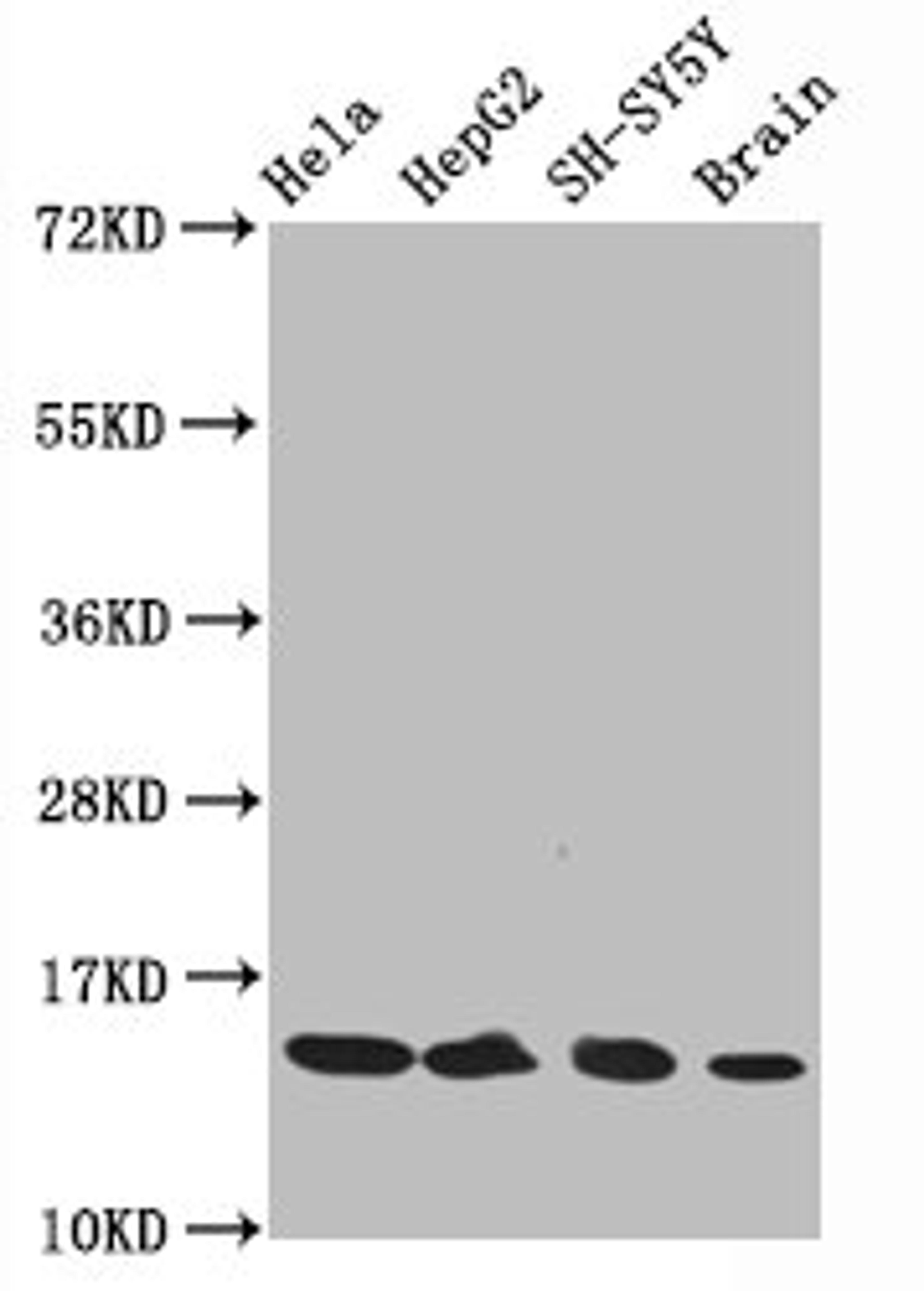 Western Blot. Positive WB detected in Hela whole cell lysate锛孒epG2 whole cell lysate锛孲H-SY5Y whole cell lysate锛孯at brain tissue. All lanes Acetyl-Histone H3.1(K14)antibody at 0.75μg/ml. Secondary. Goat polyclonal to rabbit IgG at 1/50000 dilution. Predicted band size: 15 KDa. Observed band size: 15 KDa.