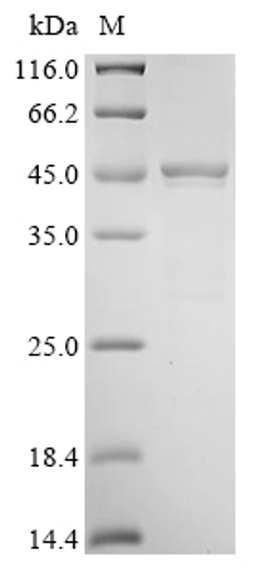 (Tris-Glycine gel) Discontinuous SDS-PAGE (reduced) with 5% enrichment gel and 15% separation gel.