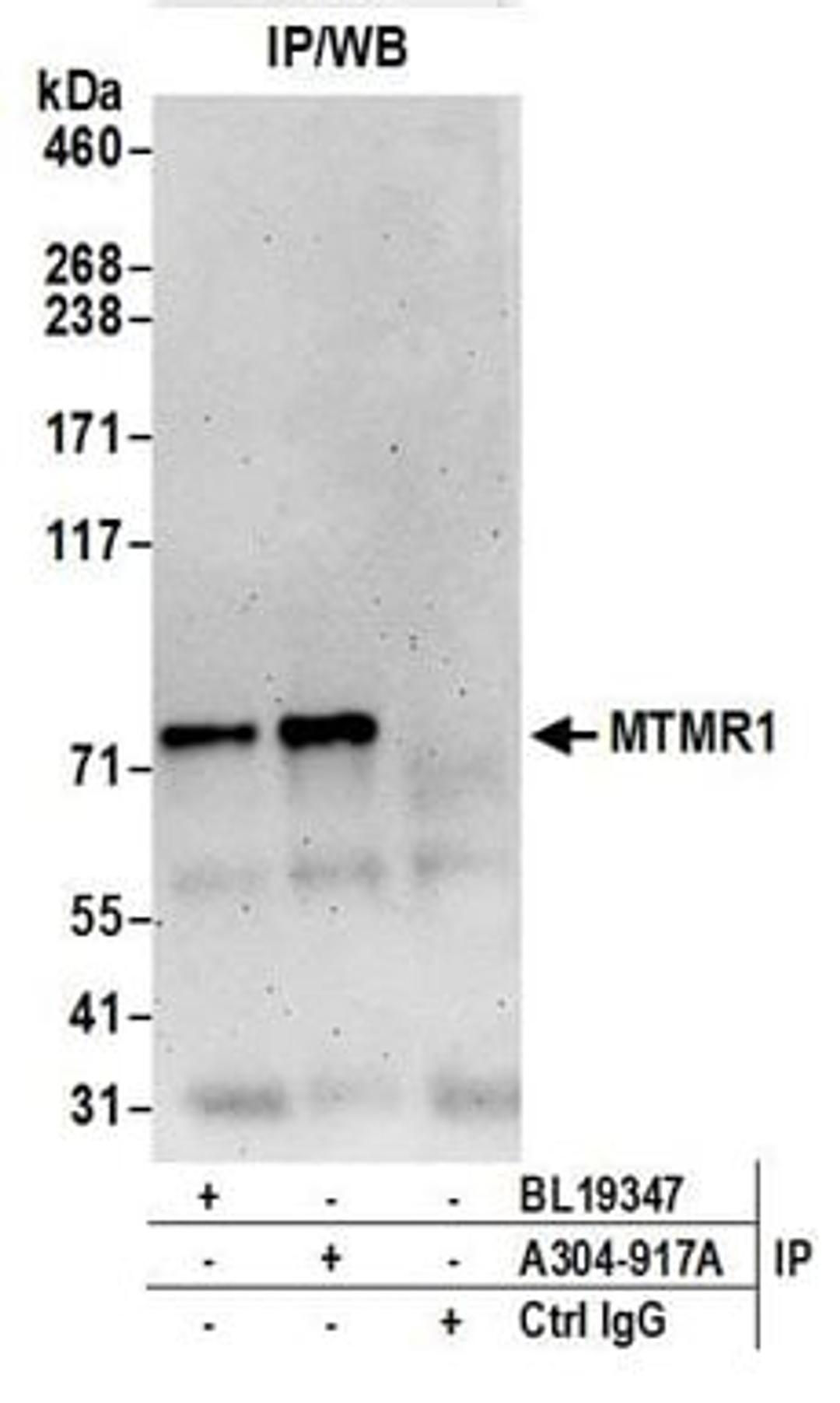 Detection of human MTMR1 by western blot of immunoprecipitates.