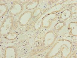 Immunohistochemistry of paraffin-embedded human kidney tissue using CSB-PA890735LA01HU at dilution of 1:100