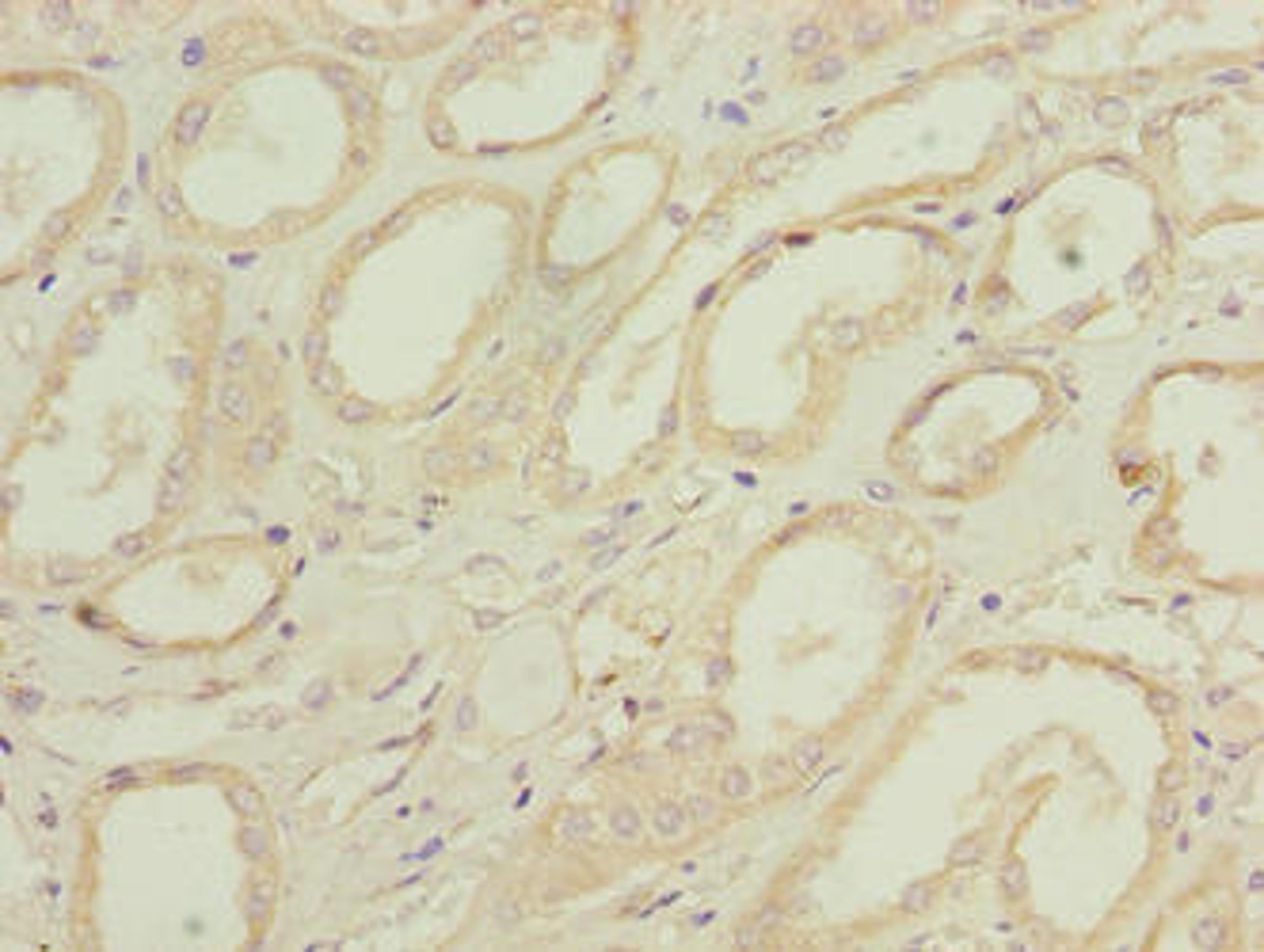 Immunohistochemistry of paraffin-embedded human kidney tissue using CSB-PA890735LA01HU at dilution of 1:100