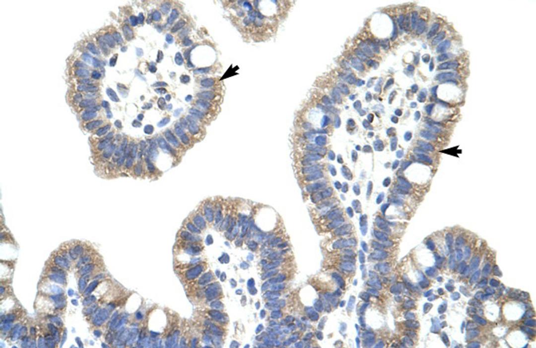 Antibody used in IHC on Human Intestine.