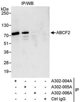 Detection of human ABCF2 by western blot of immunoprecipitates.