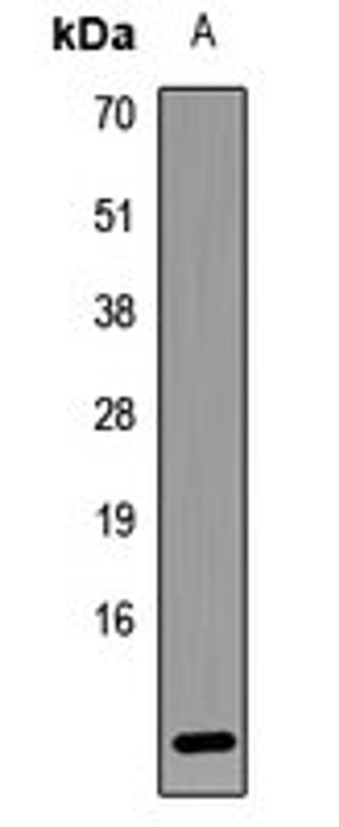 Western blot analysis of MCF7 (Lane1) whole cell lysates using LAMTOR5 antibody