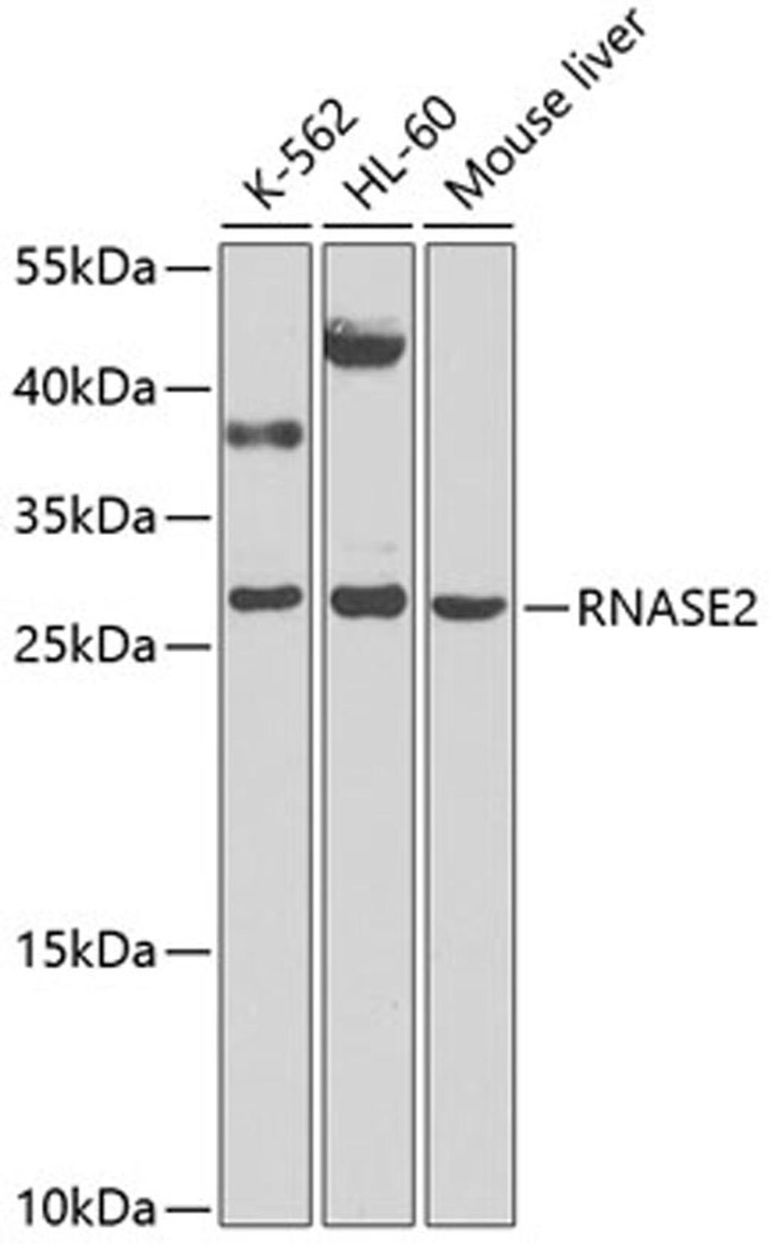 Western blot - RNASE2 antibody (A9949)