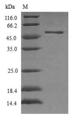 (Tris-Glycine gel) Discontinuous SDS-PAGE (reduced) with 5% enrichment gel and 15% separation gel.