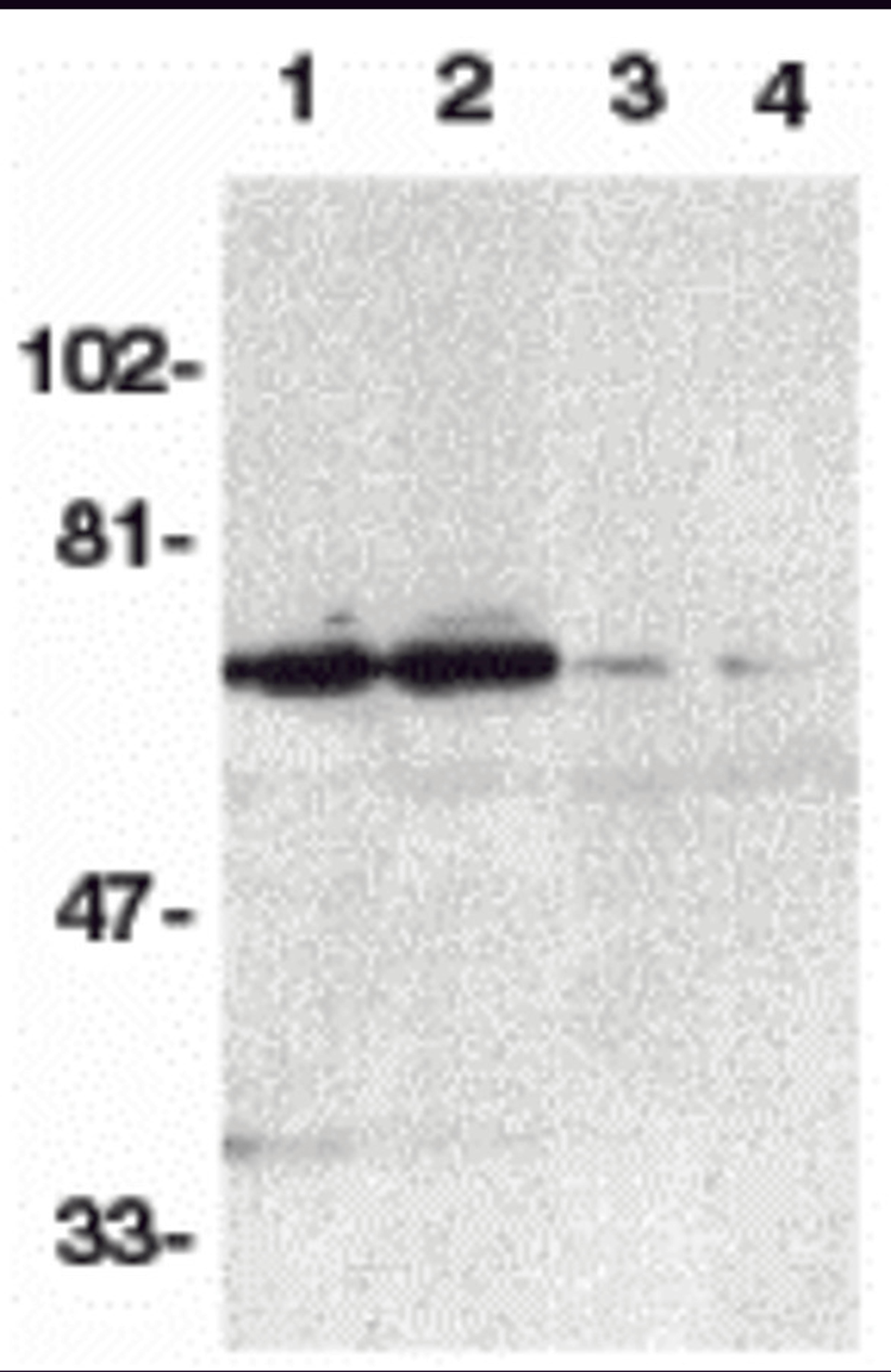 Western blot analysis of DR6 in K562 (1,3) and Raji (2,4) whole cell lysate in the absence (1,2) or presence (3,4) of blocking peptide (Catalog no. 2157P) with DR6 antibody at 1:500 dilution. 