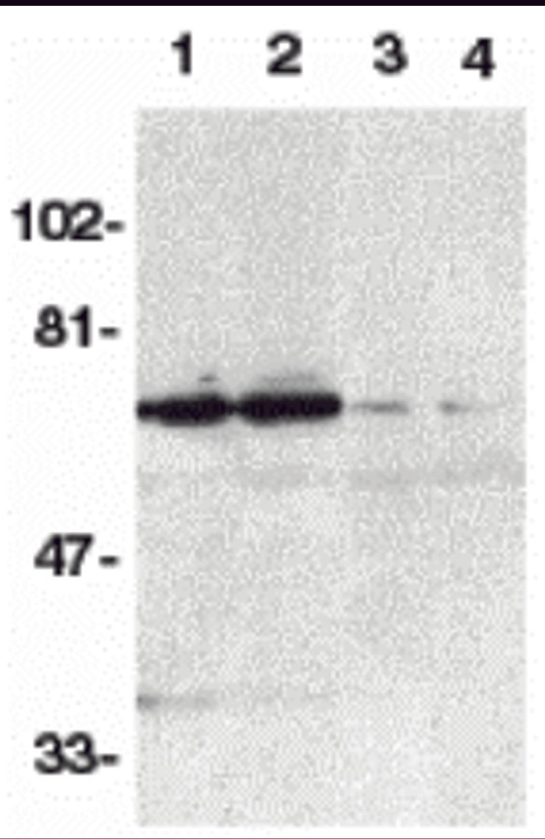 Western blot analysis of DR6 in K562 (1,3) and Raji (2,4) whole cell lysate in the absence (1,2) or presence (3,4) of blocking peptide (Catalog no. 2157P) with DR6 antibody at 1:500 dilution.