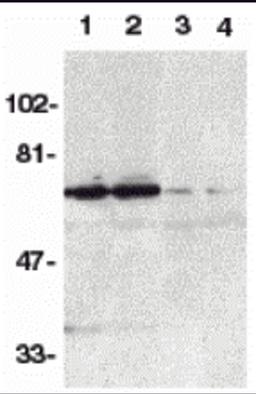 Western blot analysis of DR6 in K562 (1,3) and Raji (2,4) whole cell lysate in the absence (1,2) or presence (3,4) of blocking peptide (Catalog no. 2157P) with DR6 antibody at 1:500 dilution.