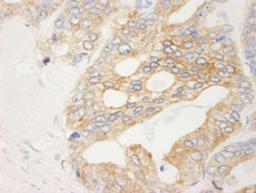 Detection of human Filamin B by immunohistochemistry.