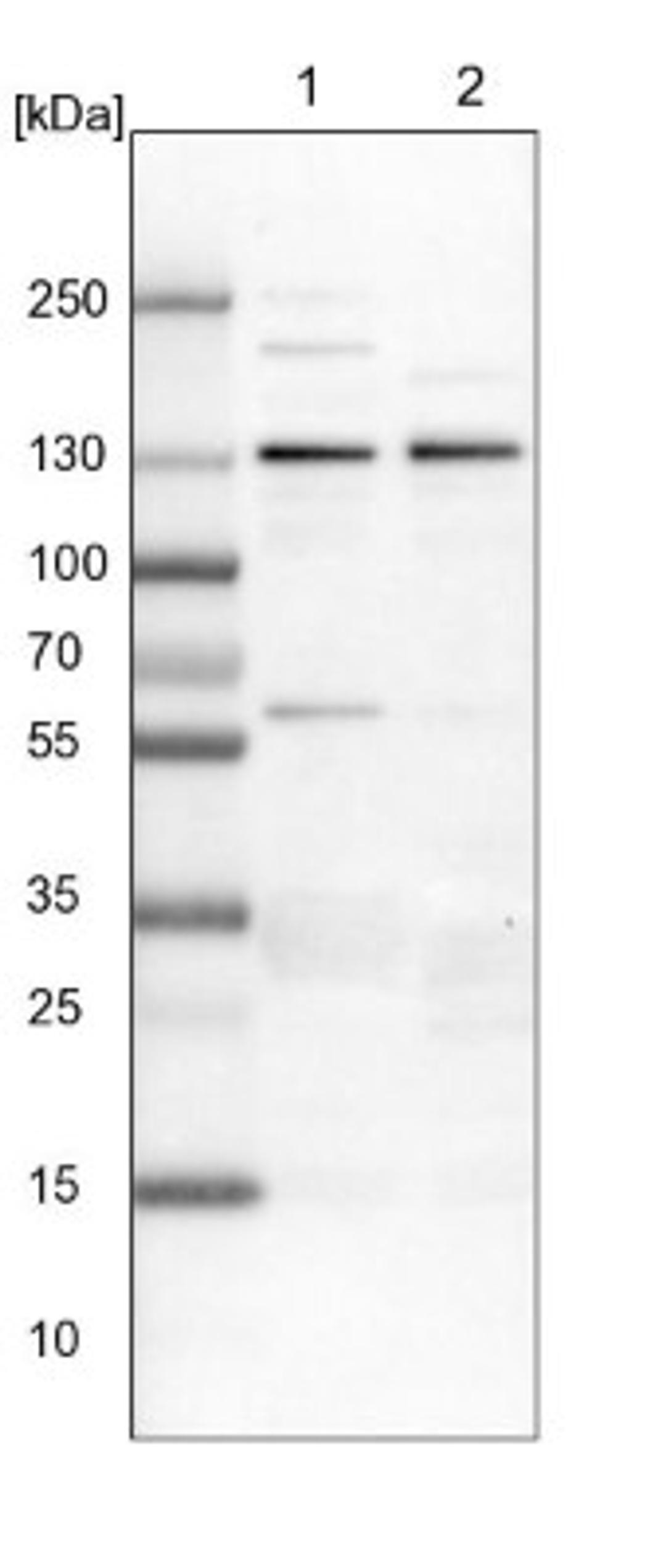 Western Blot: USP48 Antibody [NBP1-83751] - Lane 1: NIH-3T3 cell lysate (Mouse embryonic fibroblast cells)<br/>Lane 2: NBT-II cell lysate (Rat Wistar bladder tumour cells)