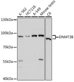 Western blot - DNMT3B antibody (A11079)