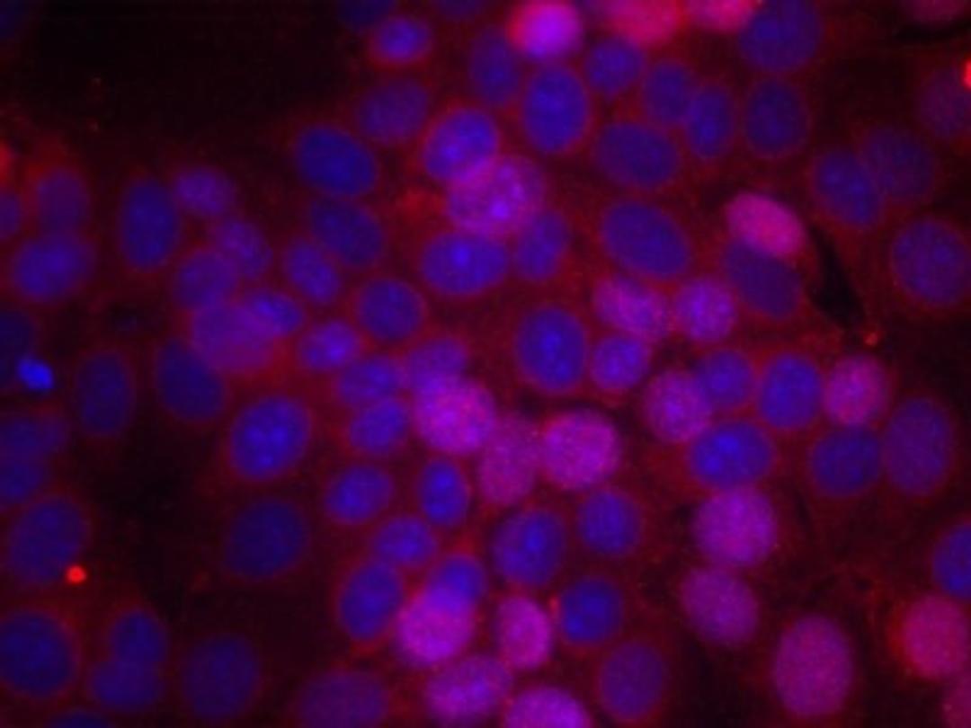 Immunocytochemistry/Immunofluorescence: Estrogen Receptor alpha [p Ser106] Antibody [NB100-81912] - Staining of methanol-fixed MCF cells using Estrogen Receptor-alpha (Phospho-Ser106) antibody.