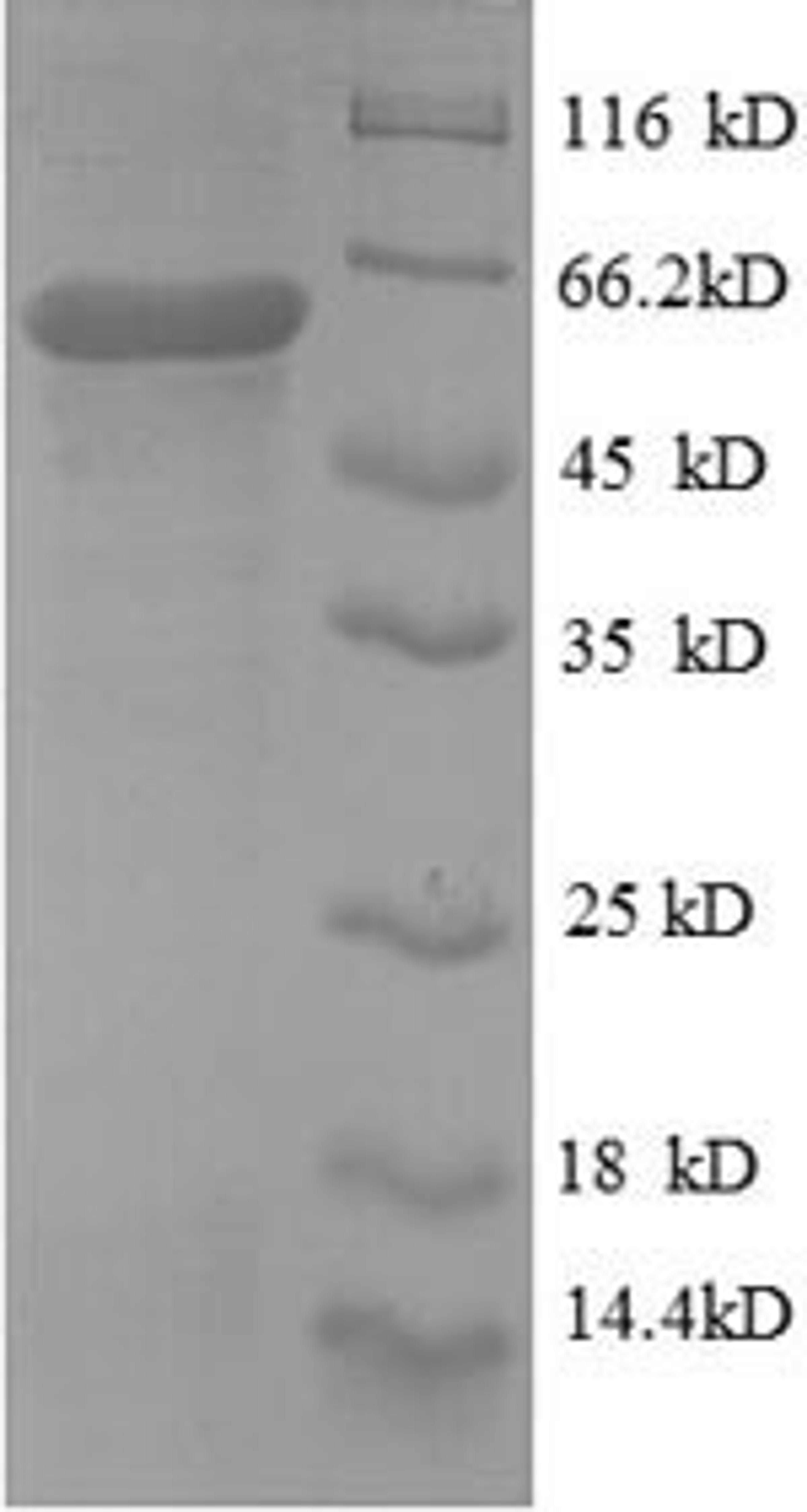 (Tris-Glycine gel) Discontinuous SDS-PAGE (reduced) with 5% enrichment gel and 15% separation gel.