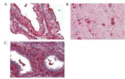 Immunohistochemistry-Paraffin: Annexin V Antibody [NB100-1930] - A) Prostate, B) Brain cortex and C) Uterus tissue. Formalin fixed, paraffin-embedded tissue after heat-induced antigen retrieval. 2.5 ug/ml of antibody used for staining. After incubation with the primary antibody, slides were incubated with biotinylated secondary antibody, followed by alkaline phosphatase-streptavidin and chromogen.