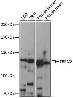 Western blot - TRPM8 antibody (A12572)