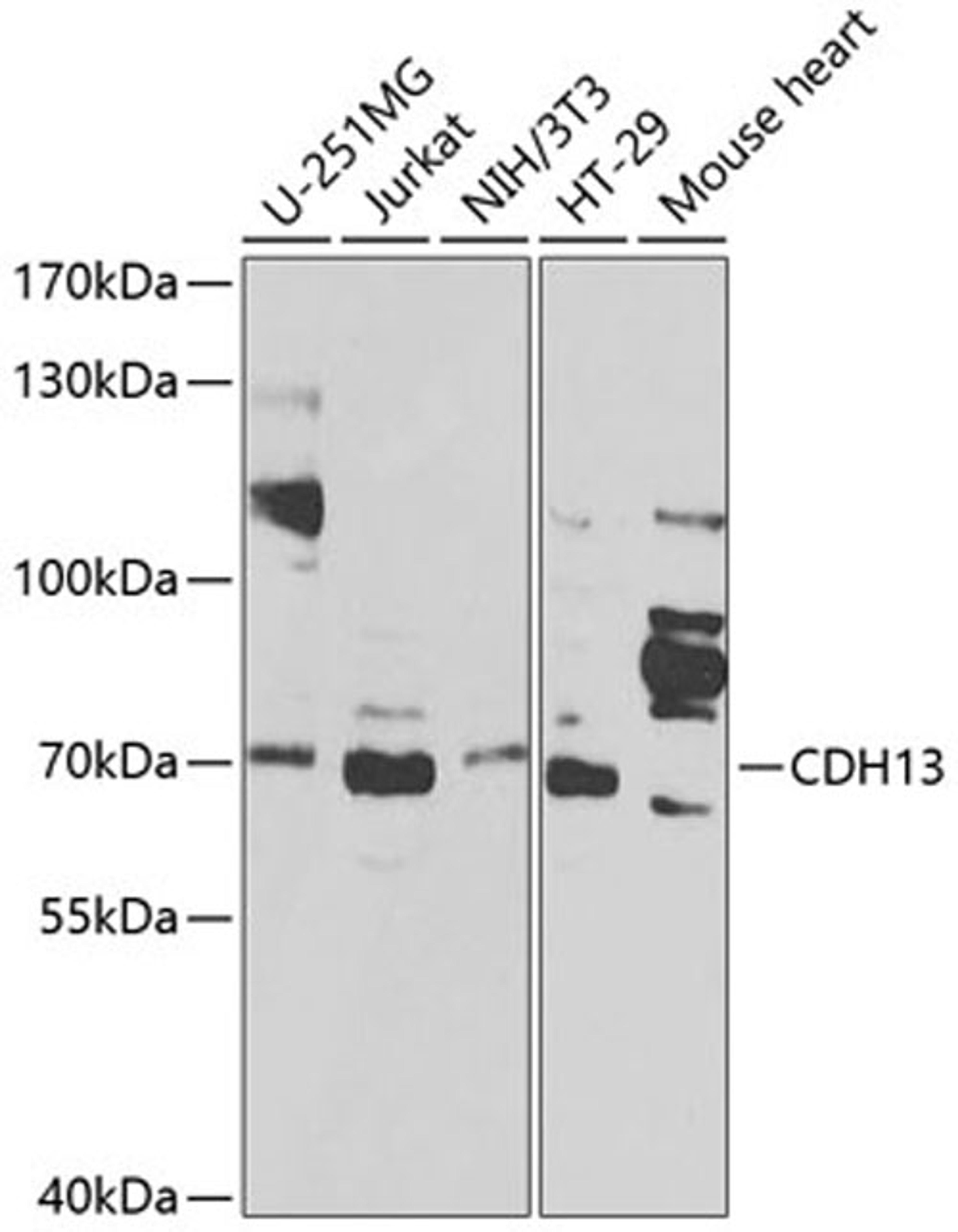 Western blot - CDH13 antibody (A1761)