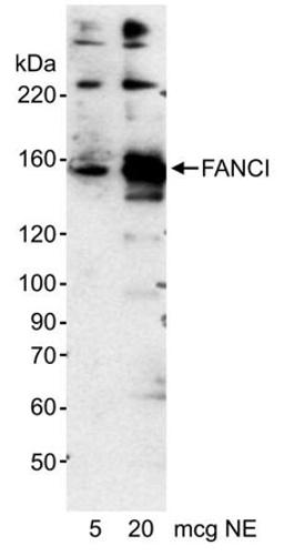 Detection of human FANCI by western blot.