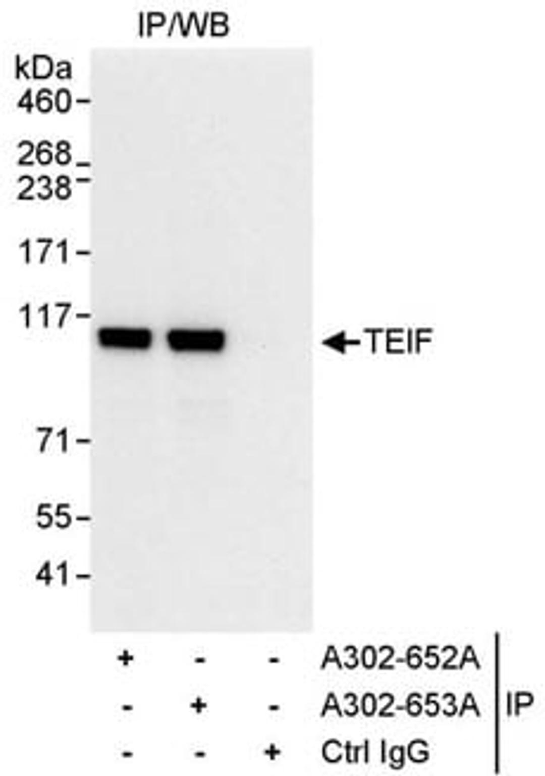 Detection of human TEIF by western blot of immunoprecipitates.