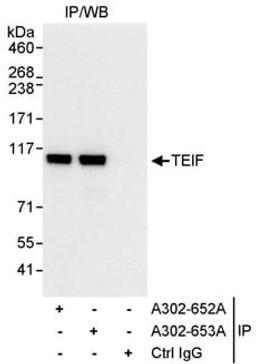 Detection of human TEIF by western blot of immunoprecipitates.