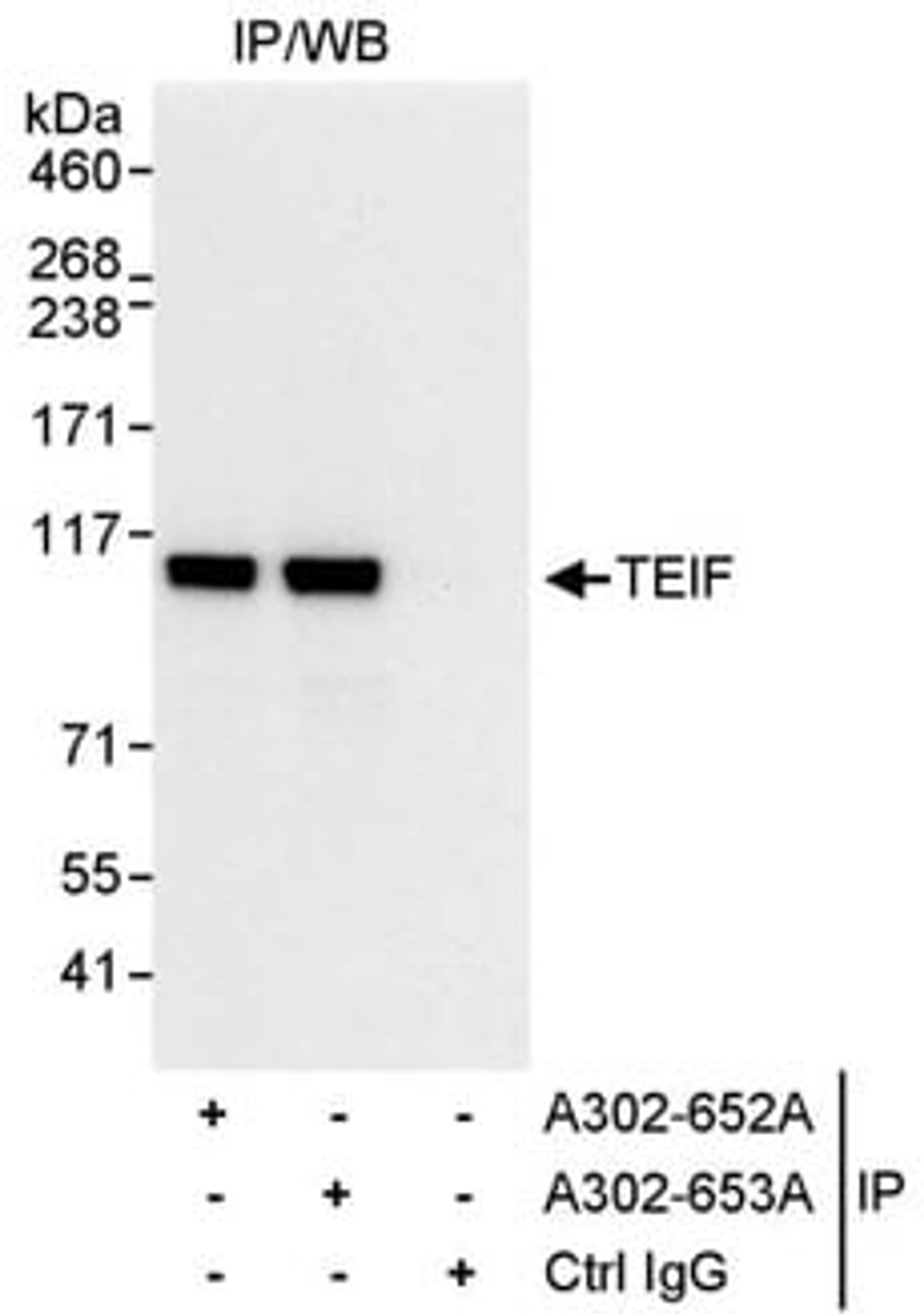 Detection of human TEIF by western blot of immunoprecipitates.