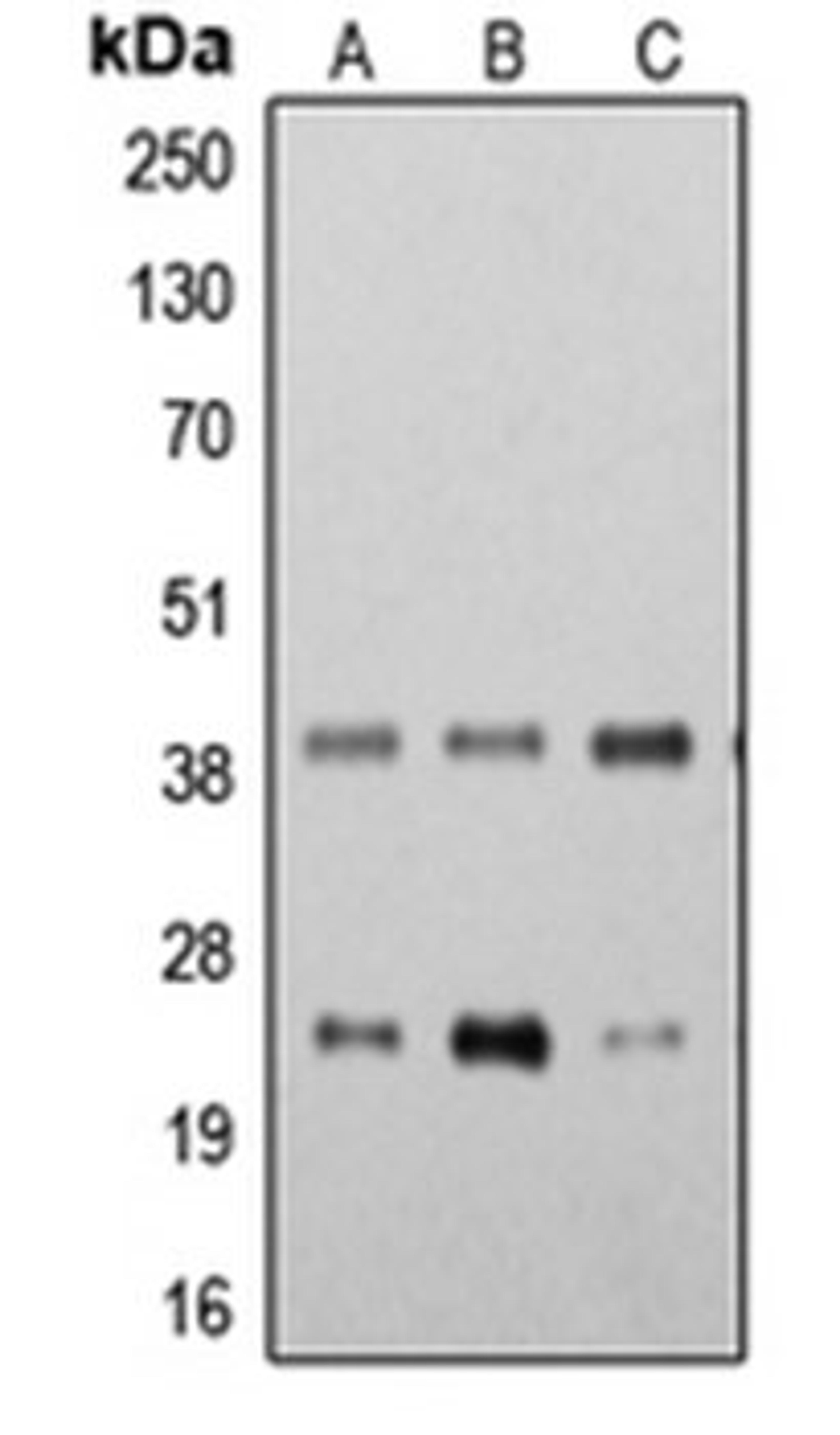 Western blot analysis of K562 (Lane 1), THP1 (Lane 2), HeLa (Lane 3) whole cell lysates using STING antibody