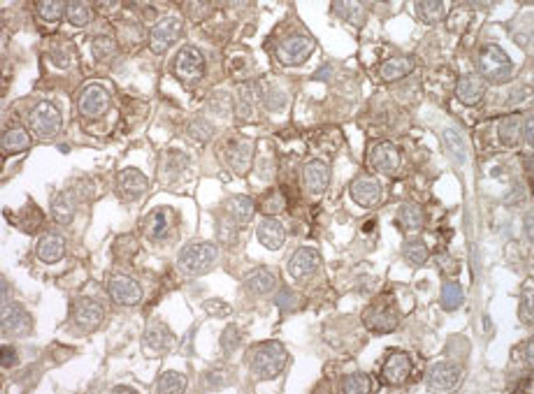 Detection of human MOV10 by immunohistochemistry.