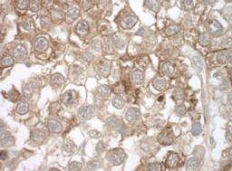 Detection of human MOV10 by immunohistochemistry.