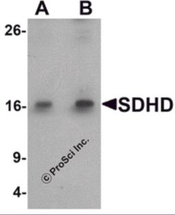 Western blot analysis of SDHD in EL4 cell lysate with SDHD antibody at (A) 1 and (B) 2 &#956;g/mL.