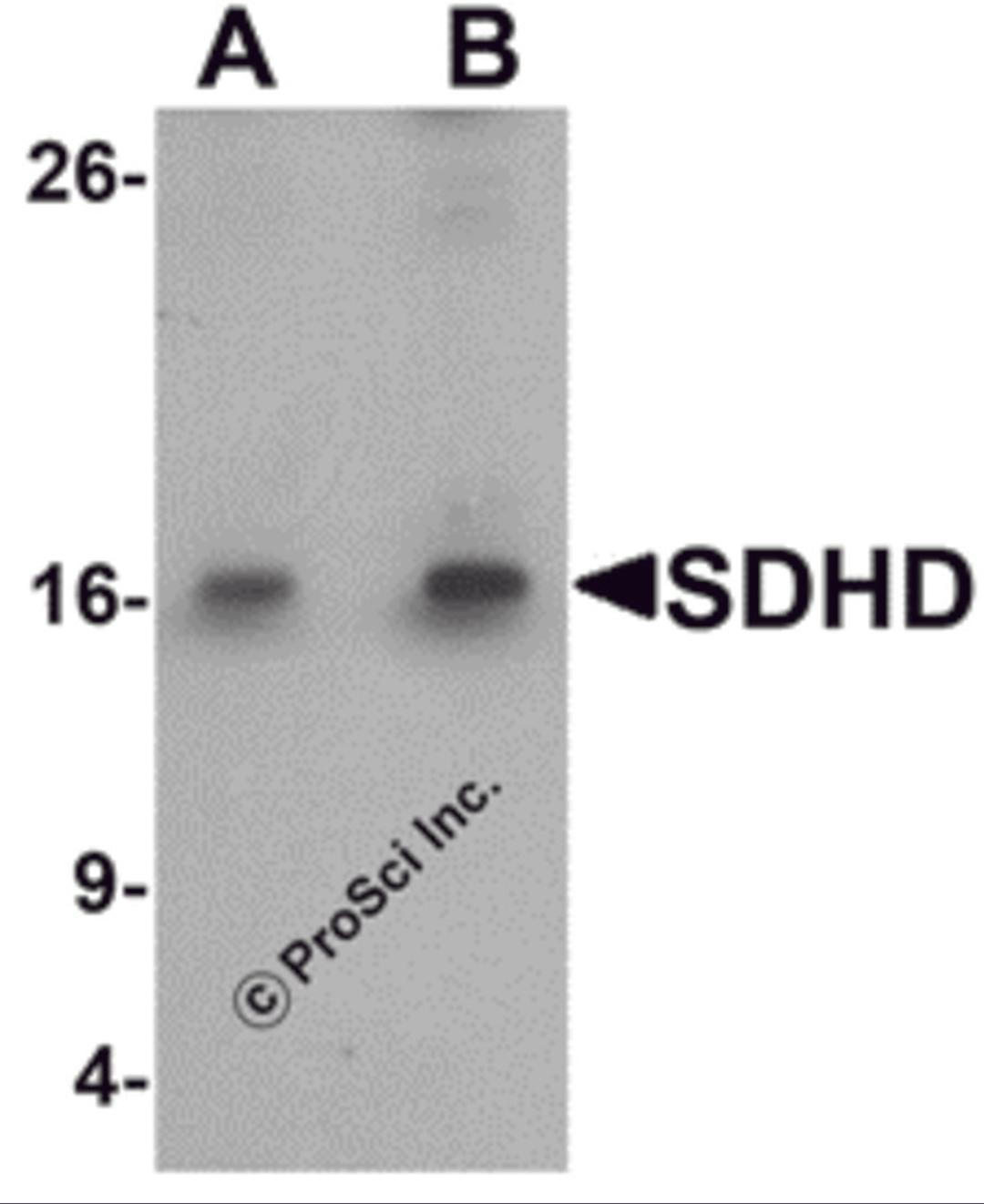 Western blot analysis of SDHD in EL4 cell lysate with SDHD antibody at (A) 1 and (B) 2 μg/mL.