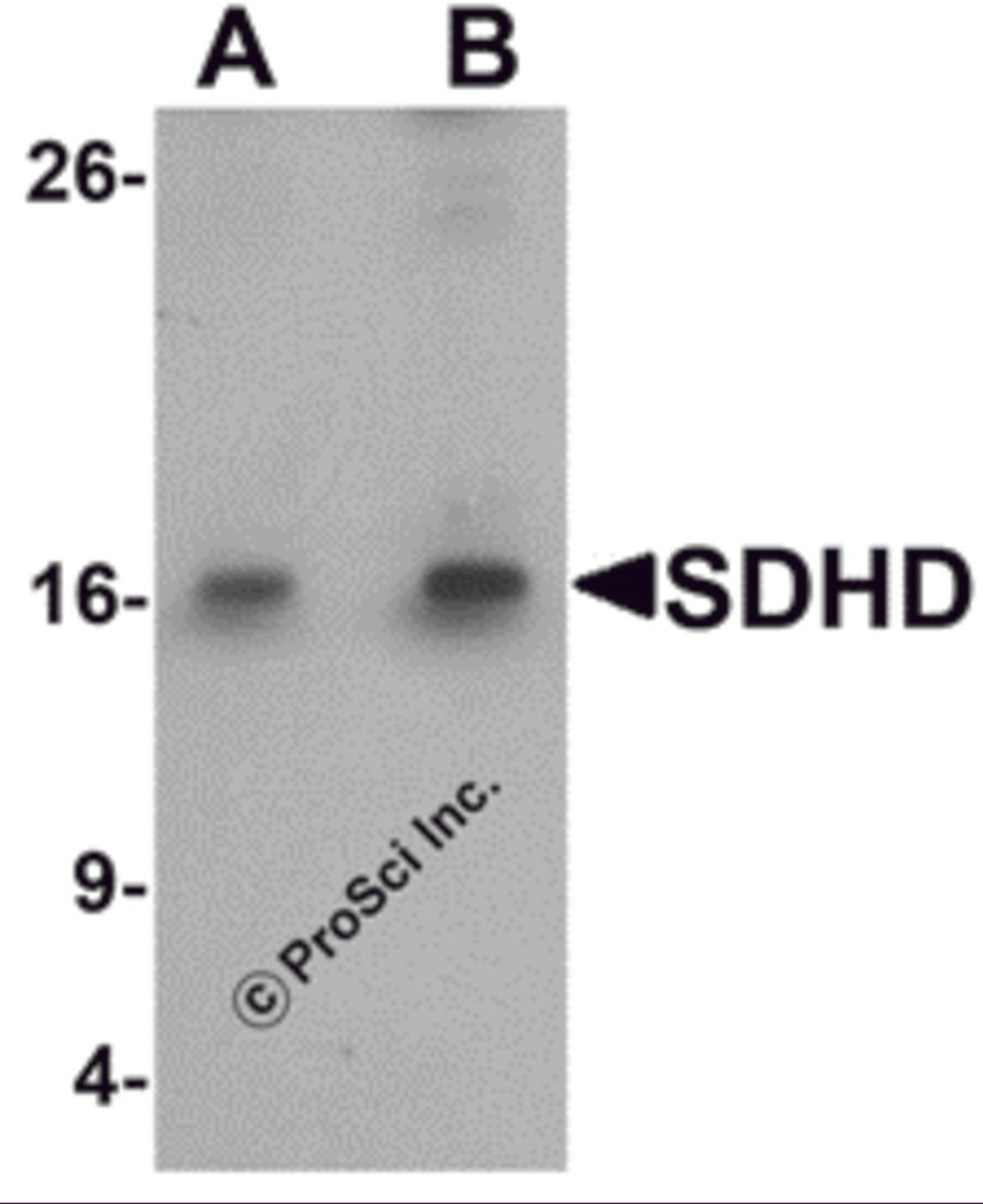 Western blot analysis of SDHD in EL4 cell lysate with SDHD antibody at (A) 1 and (B) 2 μg/mL.