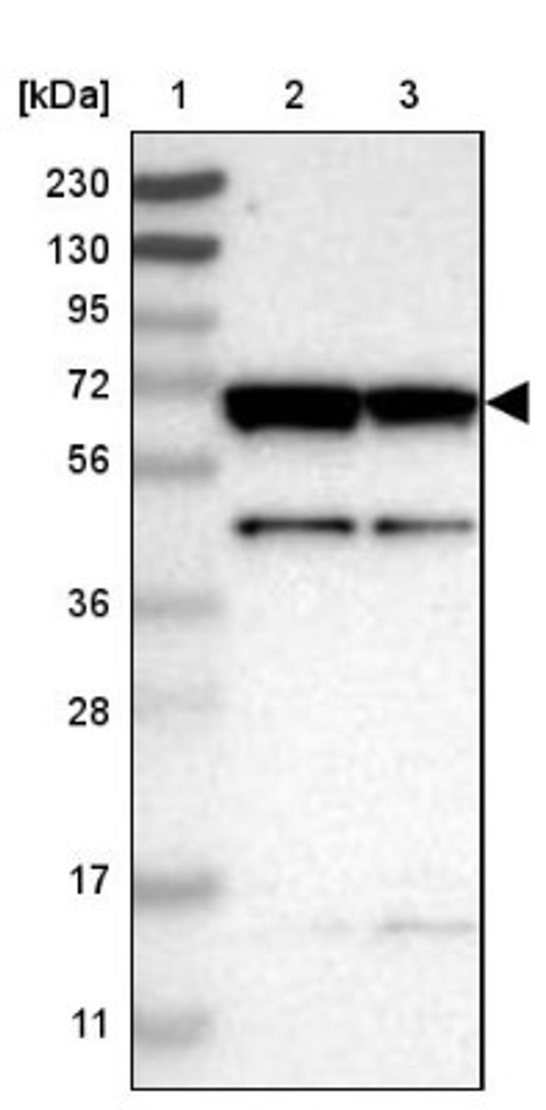 Western Blot: CROT Antibody [NBP1-85501] - Lane 1: Marker [kDa] 230, 130, 95, 72, 56, 36, 28, 17, 11<br/>Lane 2: Human cell line RT-4<br/>Lane 3: Human cell line U-251MG sp