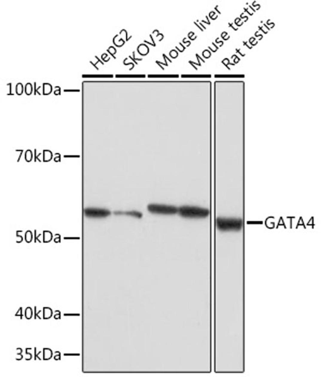 Western blot - GATA4 Rabbit mAb (A4306)