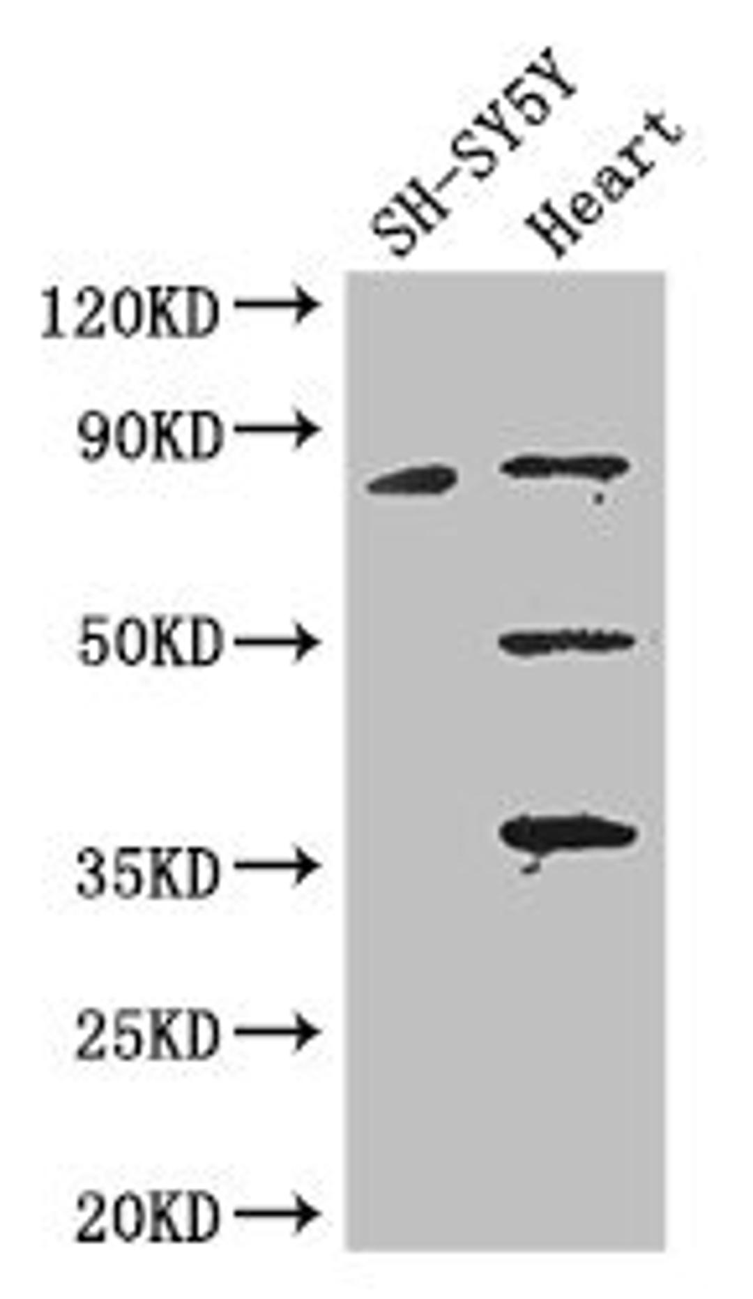 Western Blot. Positive WB detected in: SH-SY5Y whole cell lysate, Mouse heart tissue. All lanes: MAPT antibody at 3.25ug/ml. Secondary. Goat polyclonal to rabbit IgG at 1/50000 dilution. Predicted band size: 79, 37, 33, 40, 43, 41, 46, 81 kDa. Observed band size: 79, 50, 36 kDa.