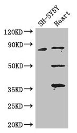 Western Blot. Positive WB detected in: SH-SY5Y whole cell lysate, Mouse heart tissue. All lanes: MAPT antibody at 3.25ug/ml. Secondary. Goat polyclonal to rabbit IgG at 1/50000 dilution. Predicted band size: 79, 37, 33, 40, 43, 41, 46, 81 kDa. Observed band size: 79, 50, 36 kDa.