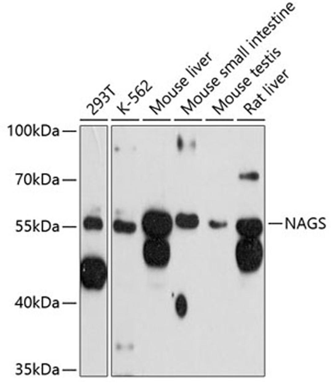 Western blot - NAGS antibody (A12086)