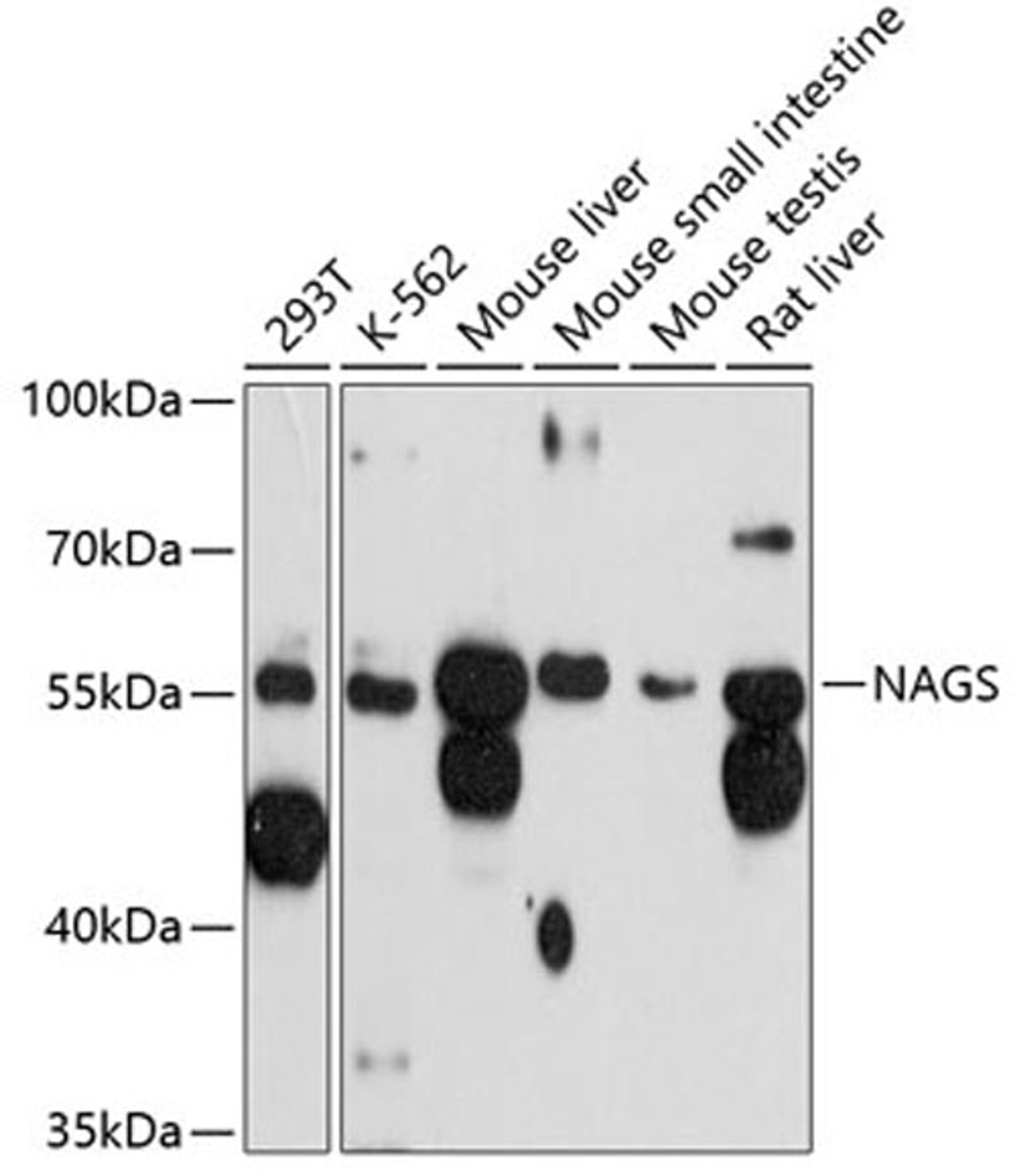 Western blot - NAGS antibody (A12086)