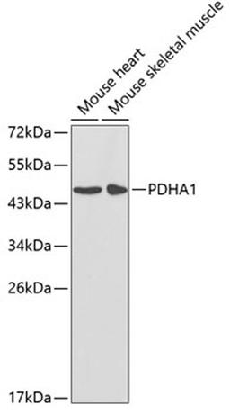 Western blot - PDHA1 antibody (A1895)