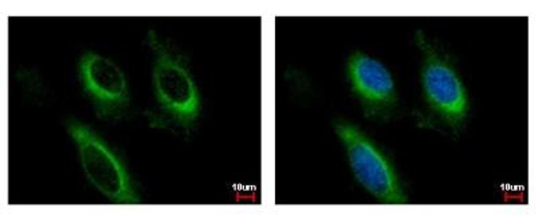 Immunocytochemistry/Immunofluorescence: IL-2 R beta Antibody [NBP1-31139] - Sample: HeLa cells were fixed in 4% paraformaldehyde at RT for 15 min. Green: IL-2 RB protein stained by IL-2 R beta antibody, C-term diluted at 1:500. Blue: Hoechst 33342 staining.