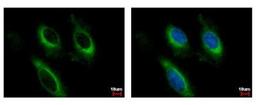 Immunocytochemistry/Immunofluorescence: IL-2 R beta Antibody [NBP1-31139] - Sample: HeLa cells were fixed in 4% paraformaldehyde at RT for 15 min. Green: IL-2 RB protein stained by IL-2 R beta antibody, C-term diluted at 1:500. Blue: Hoechst 33342 staining.