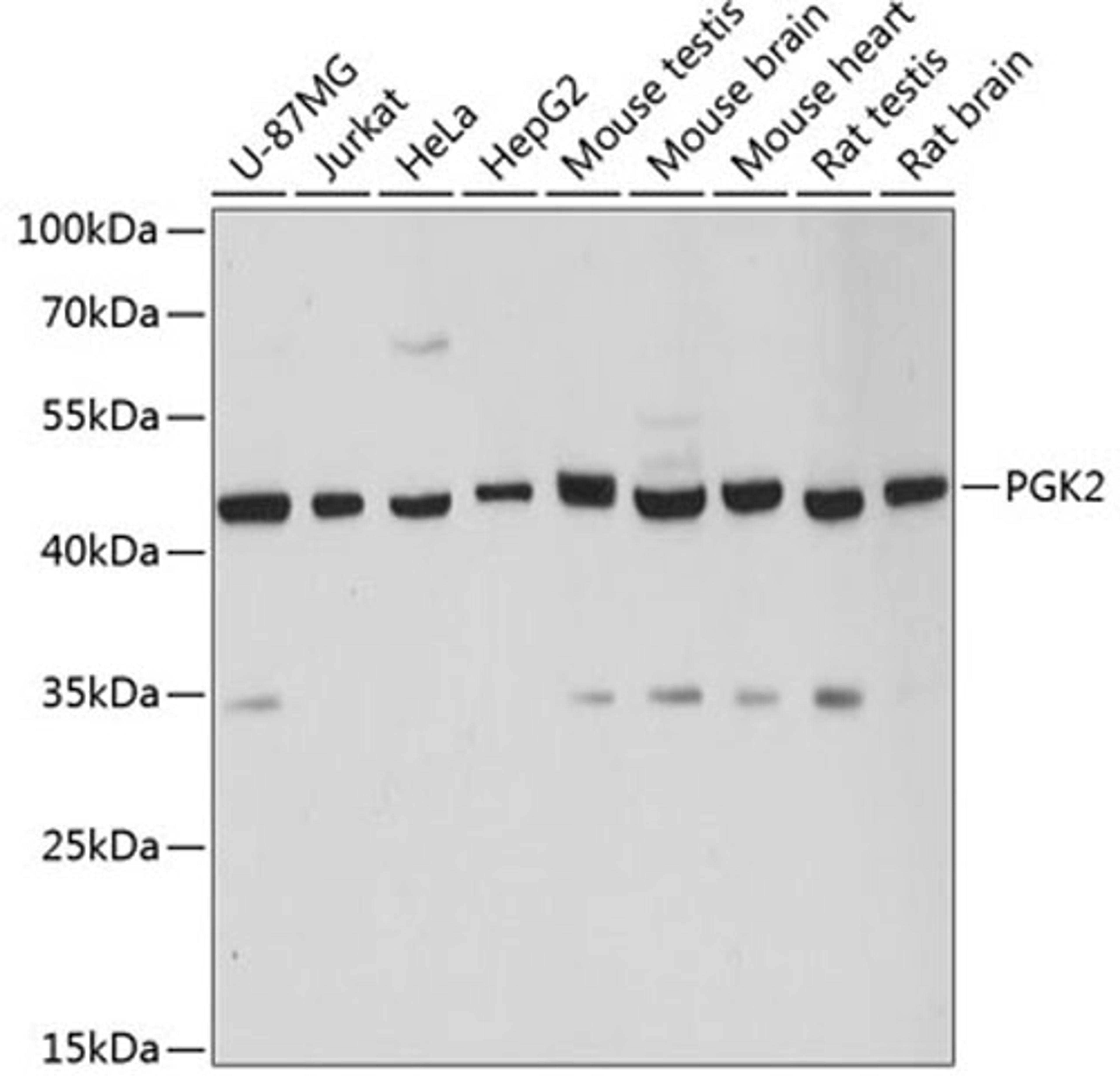 Western blot - PGK2 antibody (A12952)