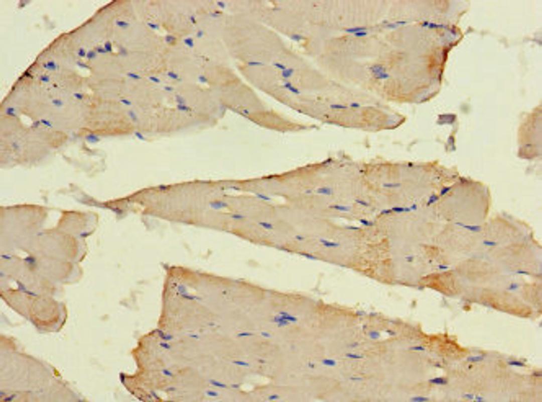 Immunohistochemistry of paraffin-embedded human skeletal muscle tissue using CSB-PA851563HA01HU at dilution of 1:100
