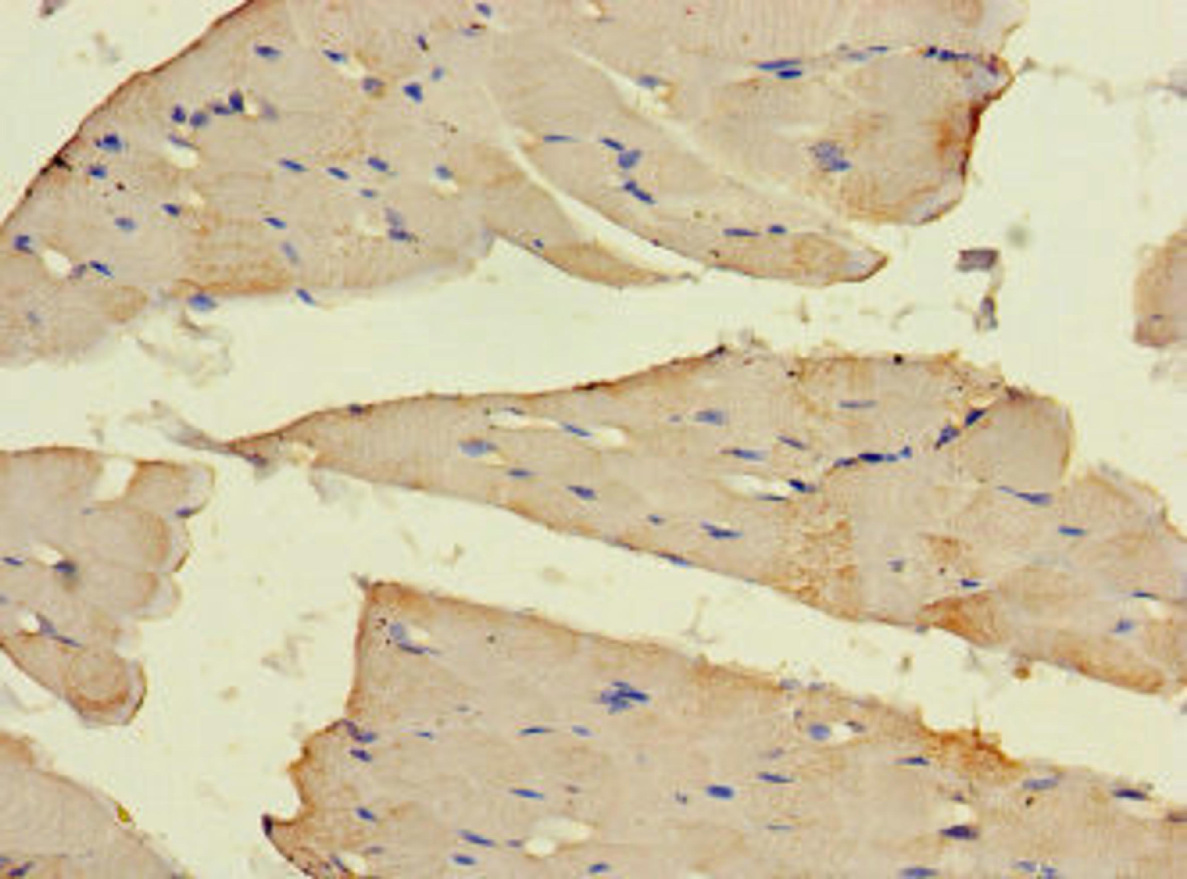 Immunohistochemistry of paraffin-embedded human skeletal muscle tissue using CSB-PA851563HA01HU at dilution of 1:100