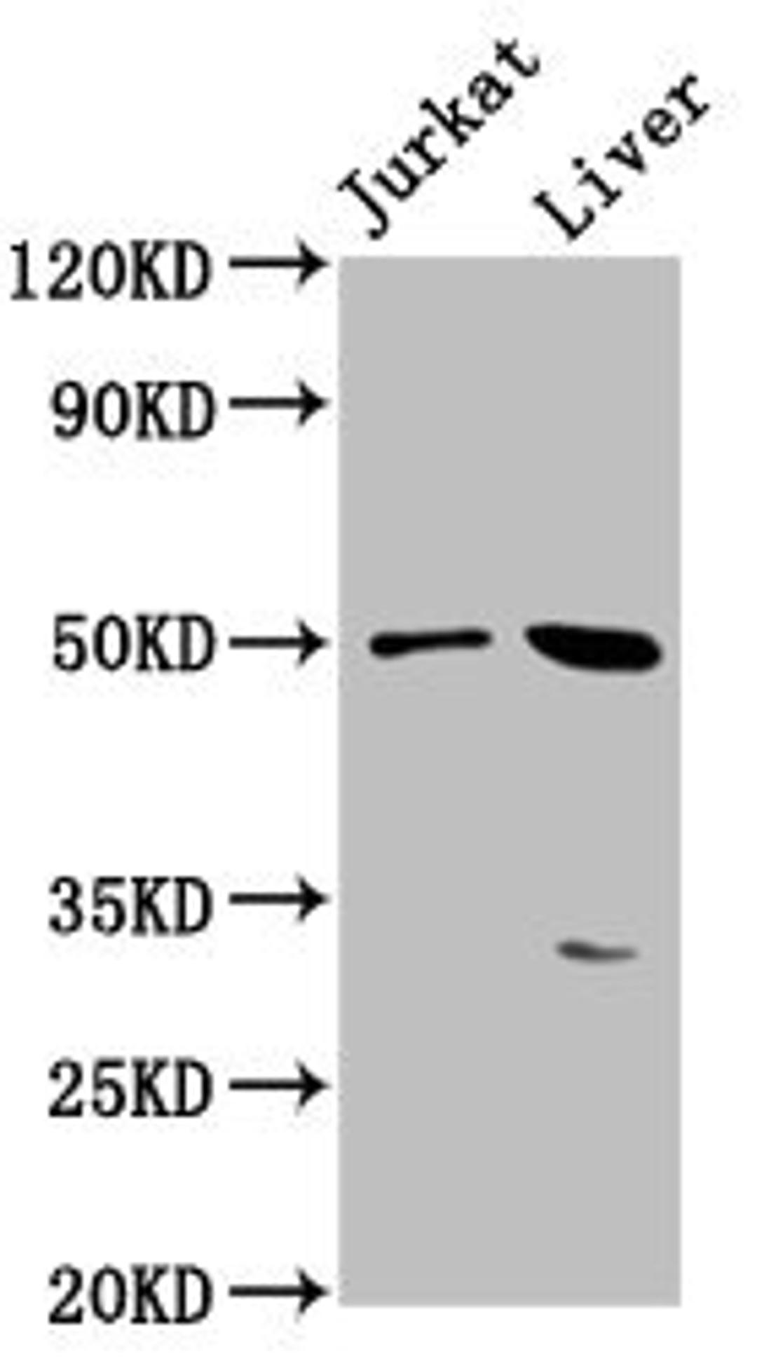 Western Blot. Positive WB detected in: Jurkat whole cell lysate, Mouse liver tissue. All lanes: BPIFB3 antibody at 3.8µg/ml. Secondary. Goat polyclonal to rabbit IgG at 1/50000 dilution. Predicted band size: 51 kDa. Observed band size: 51 kDa