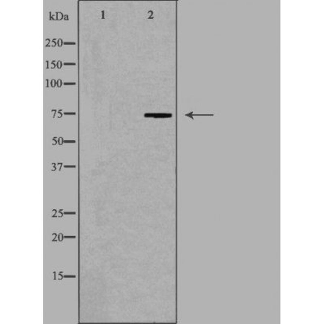 Western blot analysis of COLO205 cells using HLX1 antibody