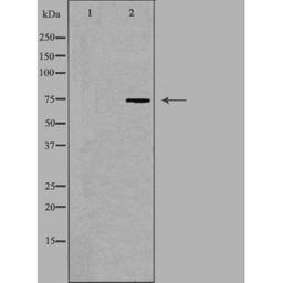 Western blot analysis of COLO205 cells using HLX1 antibody