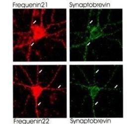 Immunofluorescence analysis of neuronal calcium sensor-1 (NCS-1) (red) and synaptobrevin (green) in hippo-campal cell cultures using Frequenin antibody