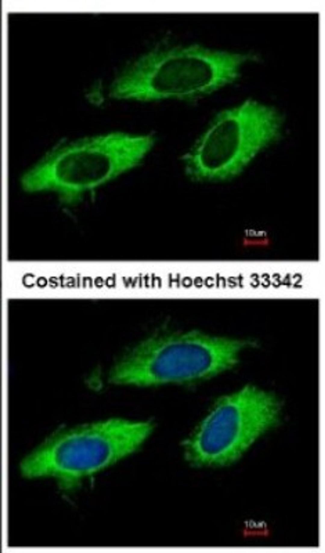 Immunocytochemistry/Immunofluorescence: RPL6 Antibody [NBP2-20216] - Immunofluorescence analysis of methanol-fixed HeLa, using antibody at 1:500 dilution.